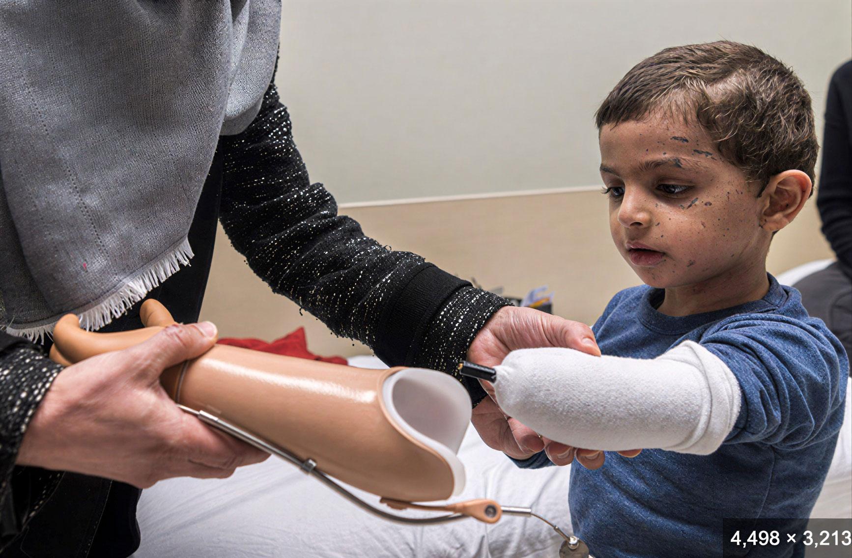 Gaza Prosthetic Limb Support Programme